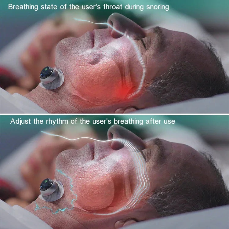 Texto alternativo de imagen